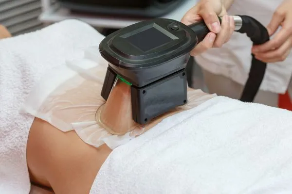 Image of person having fat freezing treatment to help weight gain Halstead