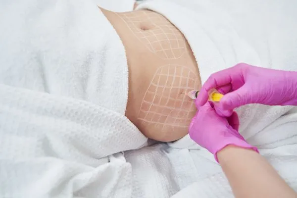 image of fat dissolving injections on love handles to help combat weight gain Halstead