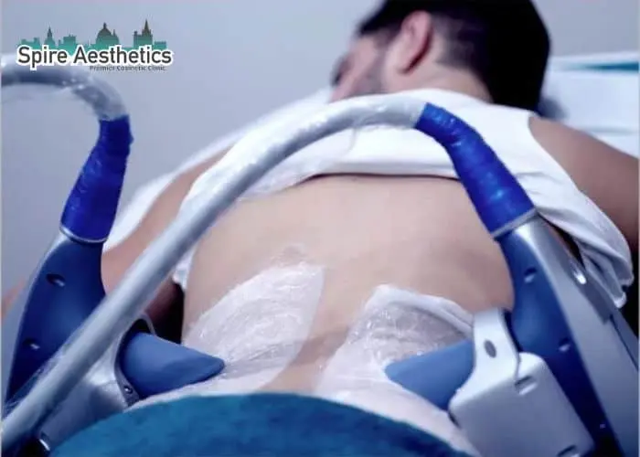 Man having fat freezing treatment done on love handles before a competitions Halstead to create a sculpted look.