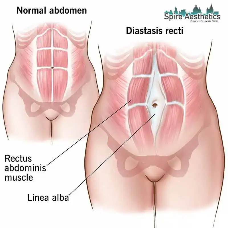 When Will My Belly Feel Normal Again Halstead?