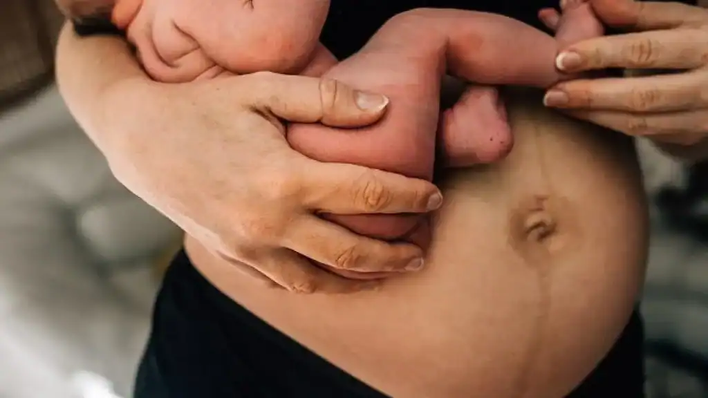 Why Is My Stomach Still Big After Pregnancy Halstead?